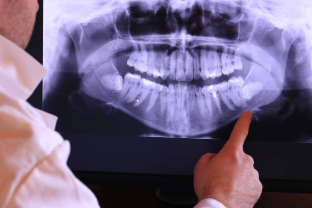 Best Urgent Care for Lost Fillings or Crowns in Simpsonville, KY