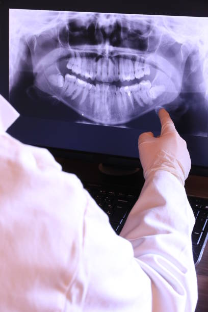 Best Emergency Treatment for Dental Infections or Abscesses in Simpsonville, KY