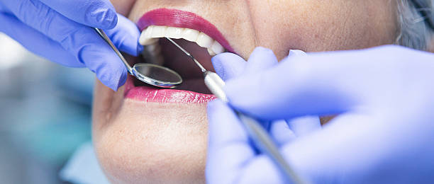 Best Emergency Dental Care for Broken or Chipped Teeth in Simpsonville, KY